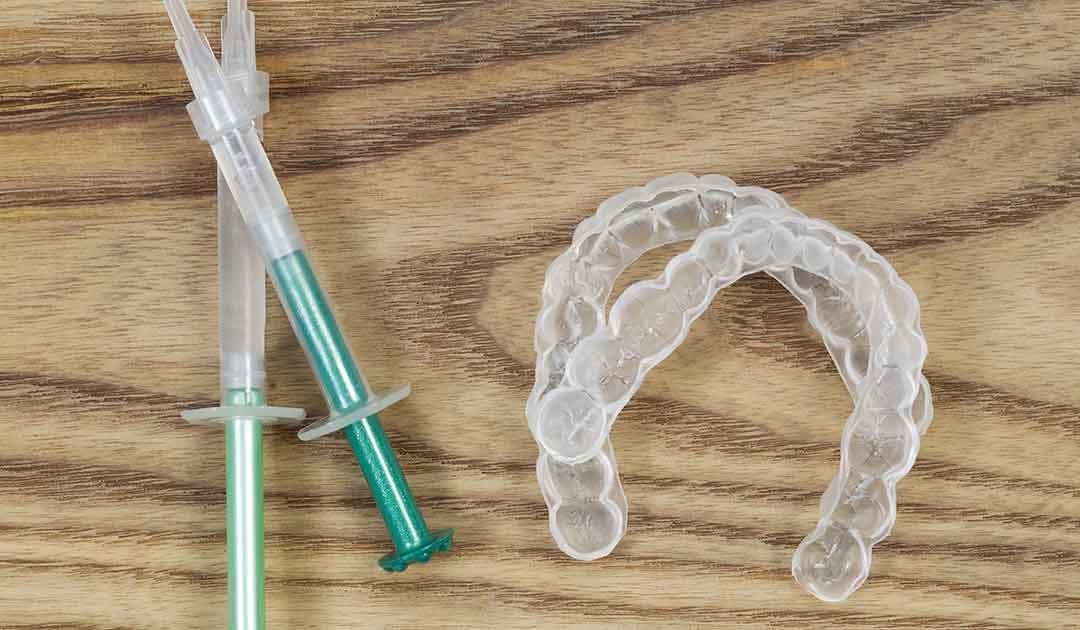2 Reasons Why You Shouldn't Use At-Home Whitening Kits
